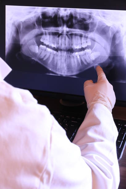 Best Emergency Tooth Extraction in Baldwin, GA